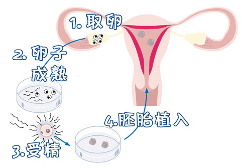 男性因素
